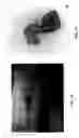 Fig. 09 - Treatment of wounds and compositions employed