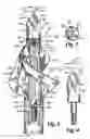 Fig. 03 - Archery broadhead tip and field tip