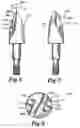 Fig. 04 - Archery broadhead tip and field tip
