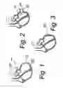 Fig. 02 - System and method for sizing a heart for treating congestive heart failure