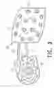 Fig. 04 - Cushion device for shoes