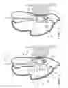 Fig. 02 - Impact beam-integrated pelvic pusher