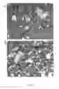 Fig. 02 - Method of ameliorating multi-organ failure resulting from ischemic reperfusion injury