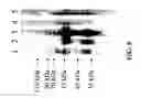 Fig. 120 - Human virus causing respiratory tract infection and uses thereof