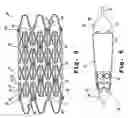 Fig. 03 - Composite stent with polymeric covering and bioactive coating