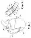 Fig. 04 - Composite stent with polymeric covering and bioactive coating