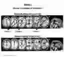 Fig. 02 - Systems and methods for detecting deception by measuring brain activity