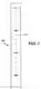 Fig. 06 - Surgical suturing apparatus with measurement structure