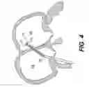 Fig. 05 - Closure devices, related delivery methods and tools, and related methods of use