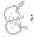 Fig. 07 - Closure devices, related delivery methods and tools, and related methods of use
