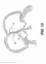 Fig. 11 - Closure devices, related delivery methods and tools, and related methods of use