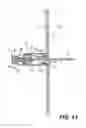 Fig. 17 - Closure devices, related delivery methods and tools, and related methods of use
