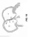 Fig. 22 - Closure devices, related delivery methods and tools, and related methods of use