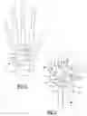 Fig. 02 - Method and apparatus for wrist arthroplasty