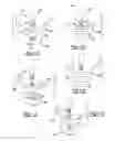 Fig. 08 - Method and apparatus for wrist arthroplasty