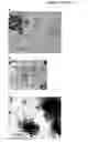 Fig. 06 - Polymer-ceramic-hydrogel composite scaffold for osteochondral repair