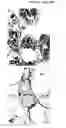 Fig. 13 - Polymer-ceramic-hydrogel composite scaffold for osteochondral repair
