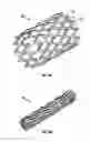 Fig. 03 - Expandable device for use in a well bore