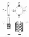 Fig. 05 - Expandable device for use in a well bore