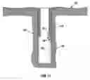 Fig. 11 - Expandable device for use in a well bore