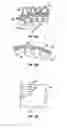 Fig. 14 - Expandable device for use in a well bore