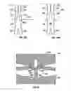 Fig. 30 - Expandable device for use in a well bore