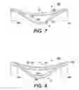Fig. 07 - Stressed material and shape memory material MEMS devices and methods for manufacturing