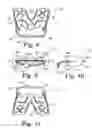 Fig. 04 - Dental measurement device