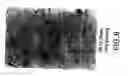Fig. 09 - GANP protein