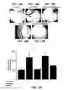Fig. 16 - Methods and compositions useful for modulation of angiogenesis using protein kinase Raf and Ras