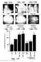 Fig. 17 - Methods and compositions useful for modulation of angiogenesis using protein kinase Raf and Ras