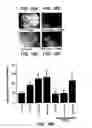 Fig. 18 - Methods and compositions useful for modulation of angiogenesis using protein kinase Raf and Ras