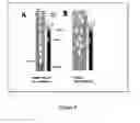 Fig. 09 - Intravascular imaging device and uses thereof