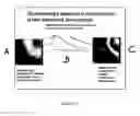 Fig. 22 - Intravascular imaging device and uses thereof