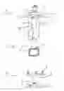 Fig. 02 - Non-invasive system for fixing navigational reference