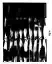 Fig. 09 - Method for muscle delivery of drugs, nucleic acids and other compounds