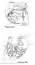 Fig. 02 - Hemocirculatory catheter and method of use thereof