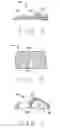 Fig. 06 - System and methods for medical device advancement and rotation