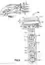 Fig. 02 - Fixation system with plate having holes with divergent axes and multidirectional fixators for use therethrough