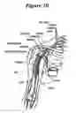 Fig. 10 - Implantable device and method for treatment of hypertension