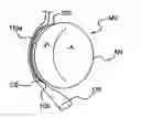 Fig. 01 - Devices and methods for heart valve treatment
