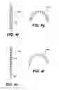 Fig. 07 - Devices and methods for heart valve treatment