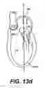 Fig. 22 - Devices and methods for heart valve treatment