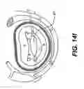 Fig. 28 - Devices and methods for heart valve treatment