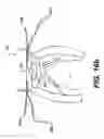 Fig. 32 - Devices and methods for heart valve treatment