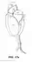 Fig. 35 - Devices and methods for heart valve treatment