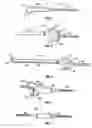 Fig. 02 - Modular orthopaedic implant system