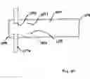 Fig. 22 - Garment with a venting structure and method of using the same
