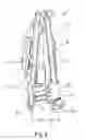 Fig. 06 - Patient lift with three-point vertical stance