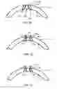 Fig. 07 - Port assembly for a spherical cavitation chamber